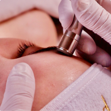 Treatment 2