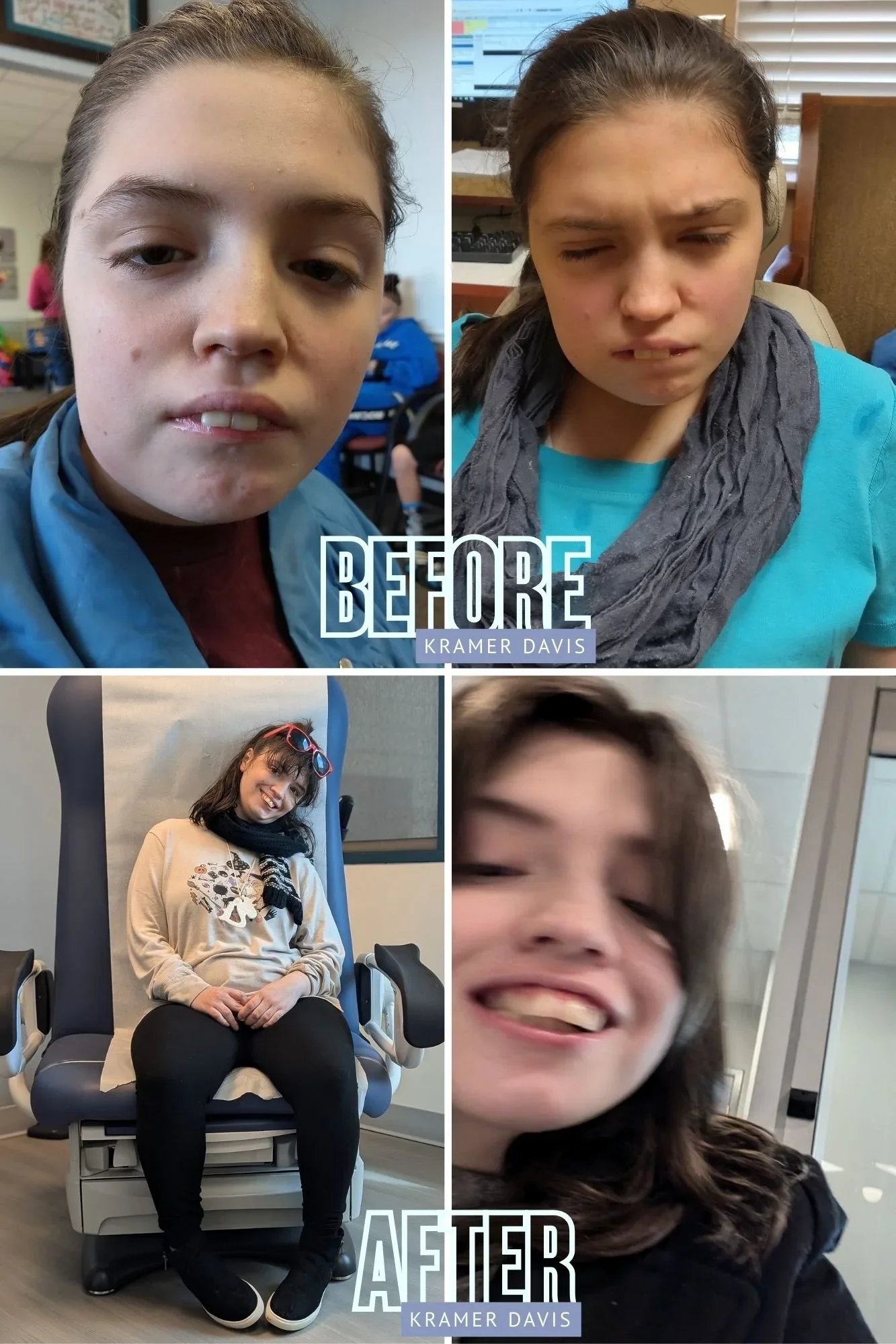  These photos tell the story: from pain and rejection to dignity and joy. Kramer Davis gave my daughter back her smile and so much more. 