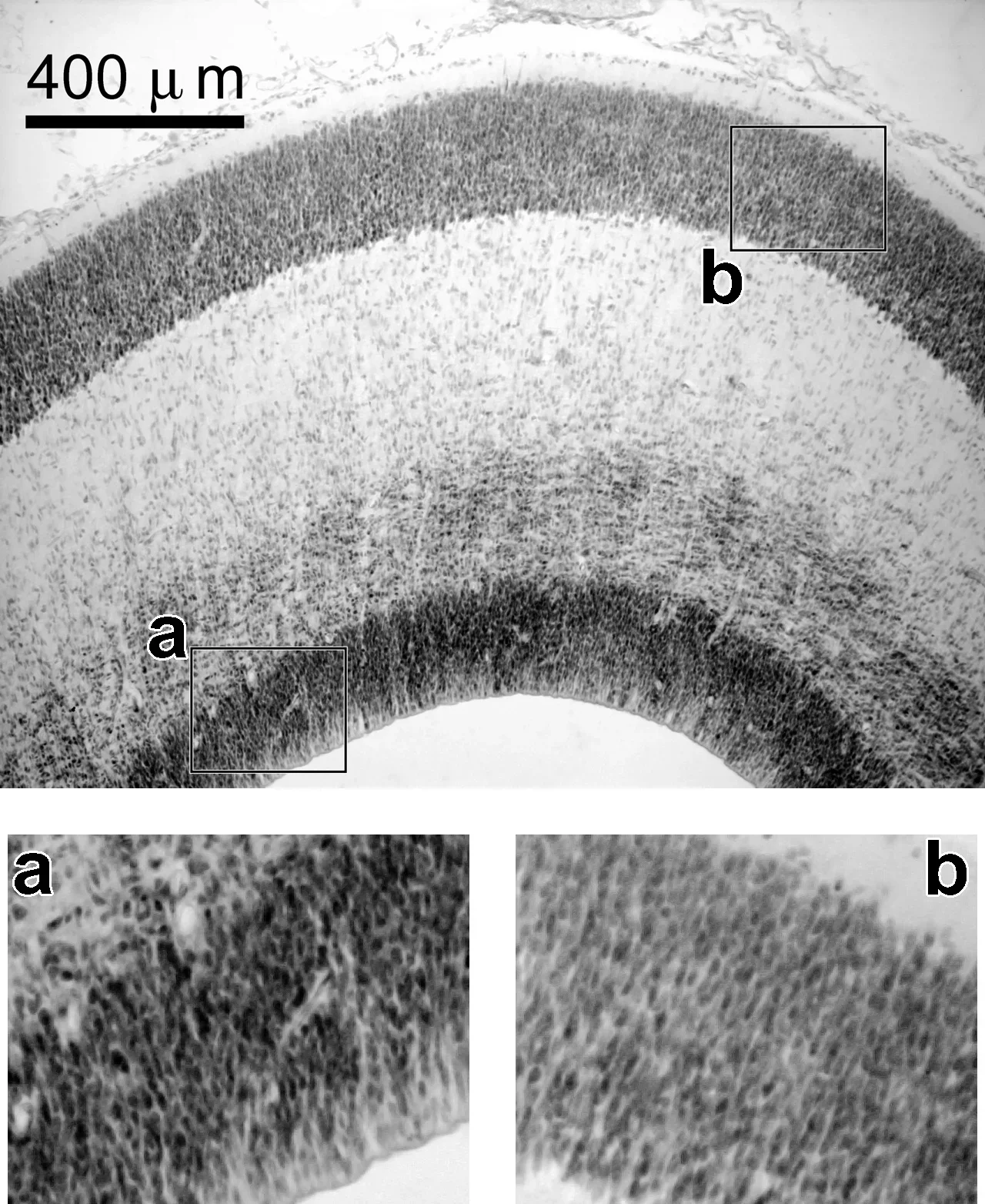  Image: The cerebral cortex is a highly organized brain structure. In early development, brain cells, labeled (a), surround the core cavities of the brain before they migrate to the cortex. They make their way through the white matter of the brain in order to reach the cortical plate (b), or future cerebral cortex. In autism, this process is often disrupted. (Image courtesy of Dr. Manuel Casanova) 
