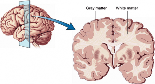  Diagram of grey and white matter of the cortex. 