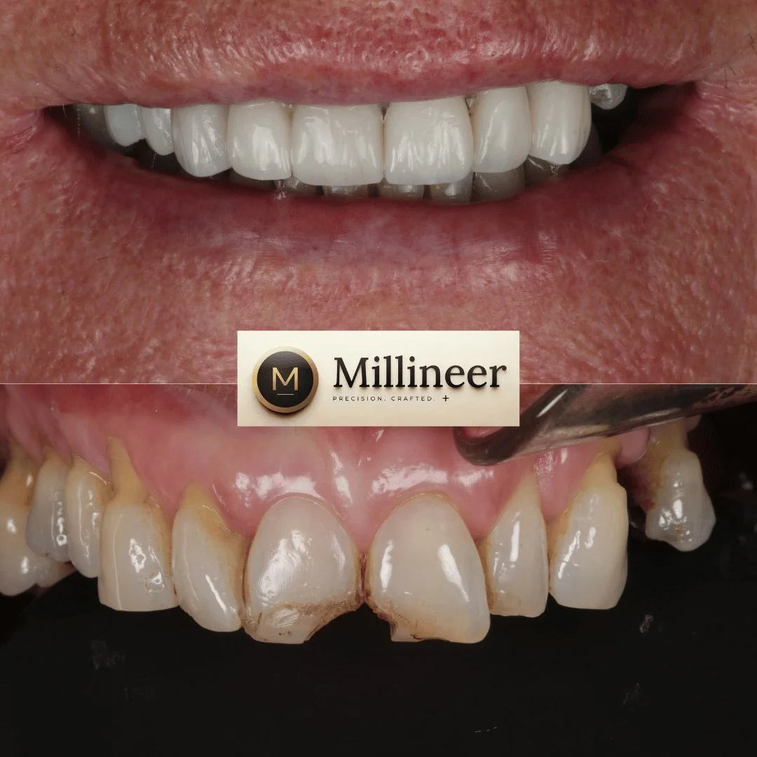 Veneer before and after, Millineer