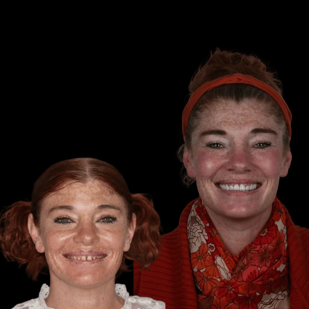 Her before and after