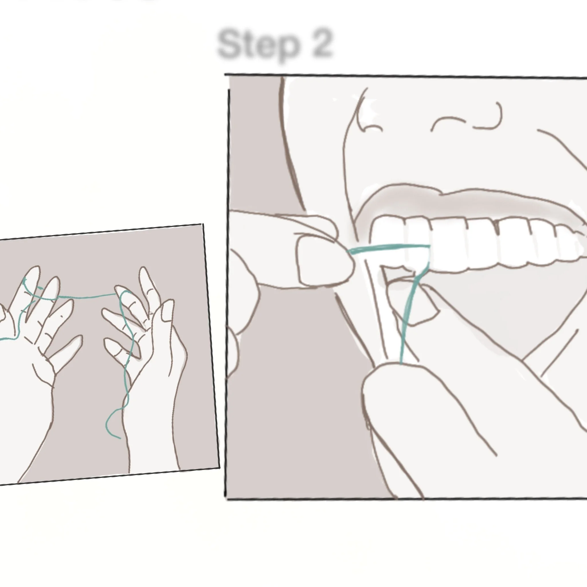 Example of Procedural Steps in Flossing