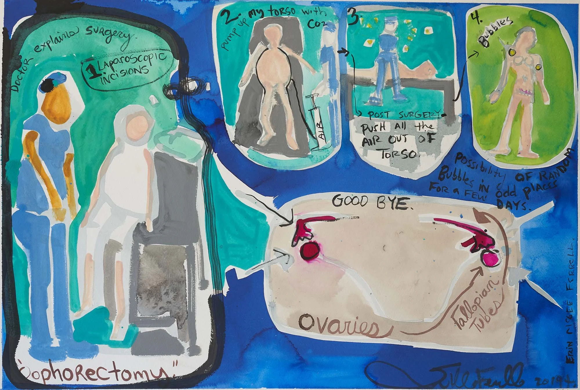 Oophorectomy, 2019: painted sequence of the artist’s experience of surgery, with figures, arrows, and handwritten descriptions.
