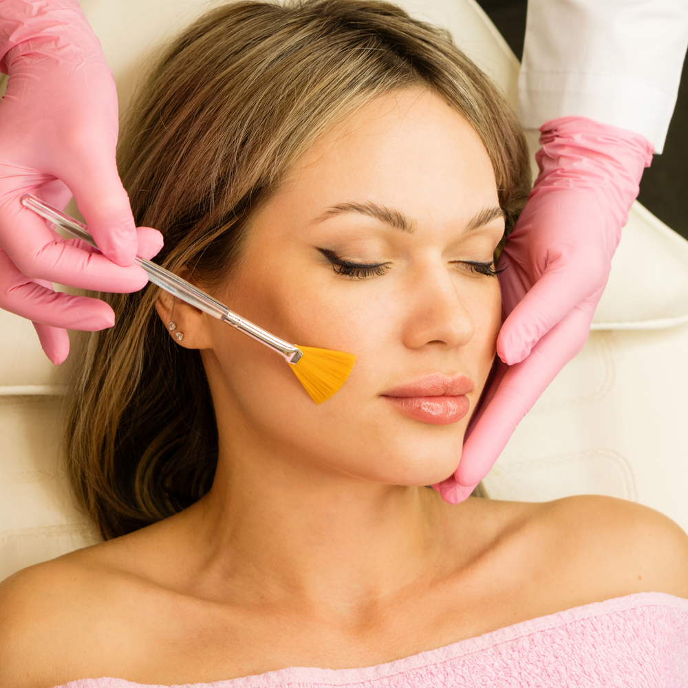 Chemical peel being applied at Midwest Dermatology Institute