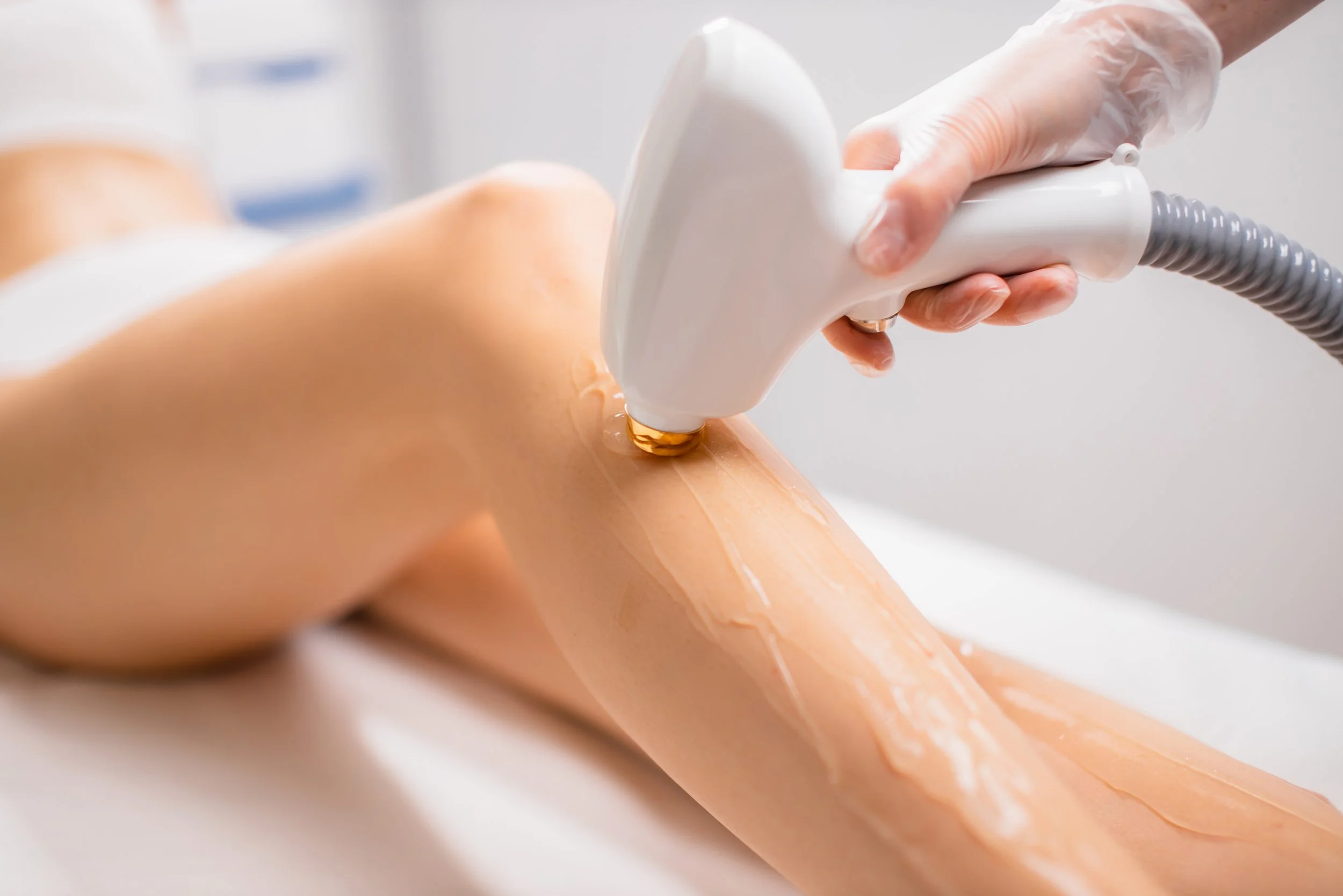 Laser hair removal at Regenesis Aesthetic + Wellness, Kent Town SA