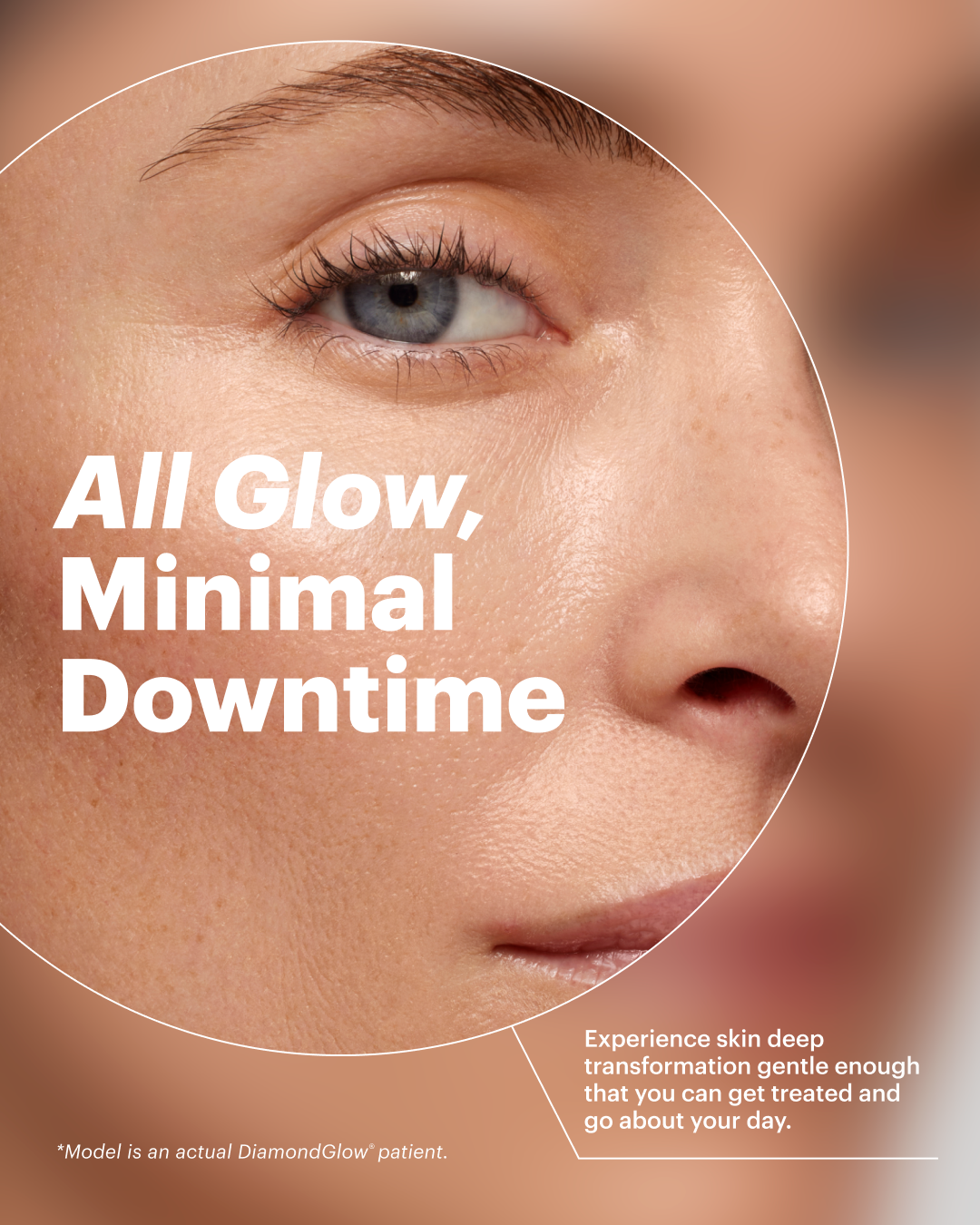 Minimal downtime with DiamondGlow at EllenBee Beauty & Wellness