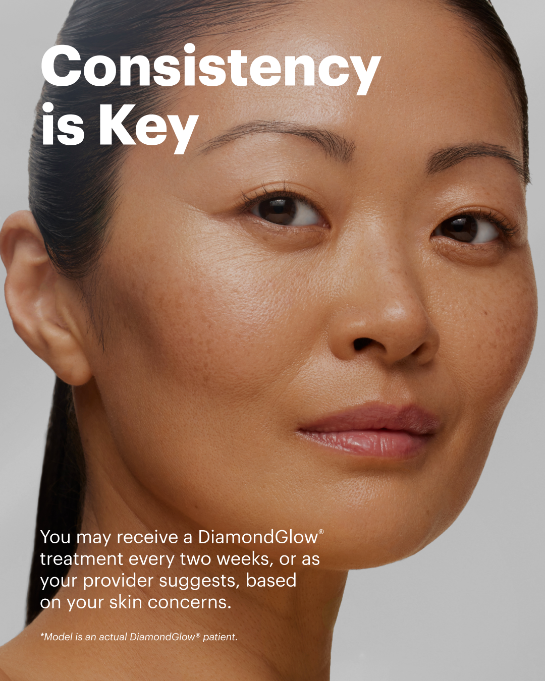 Consistency is key with DiamondGlow treatments