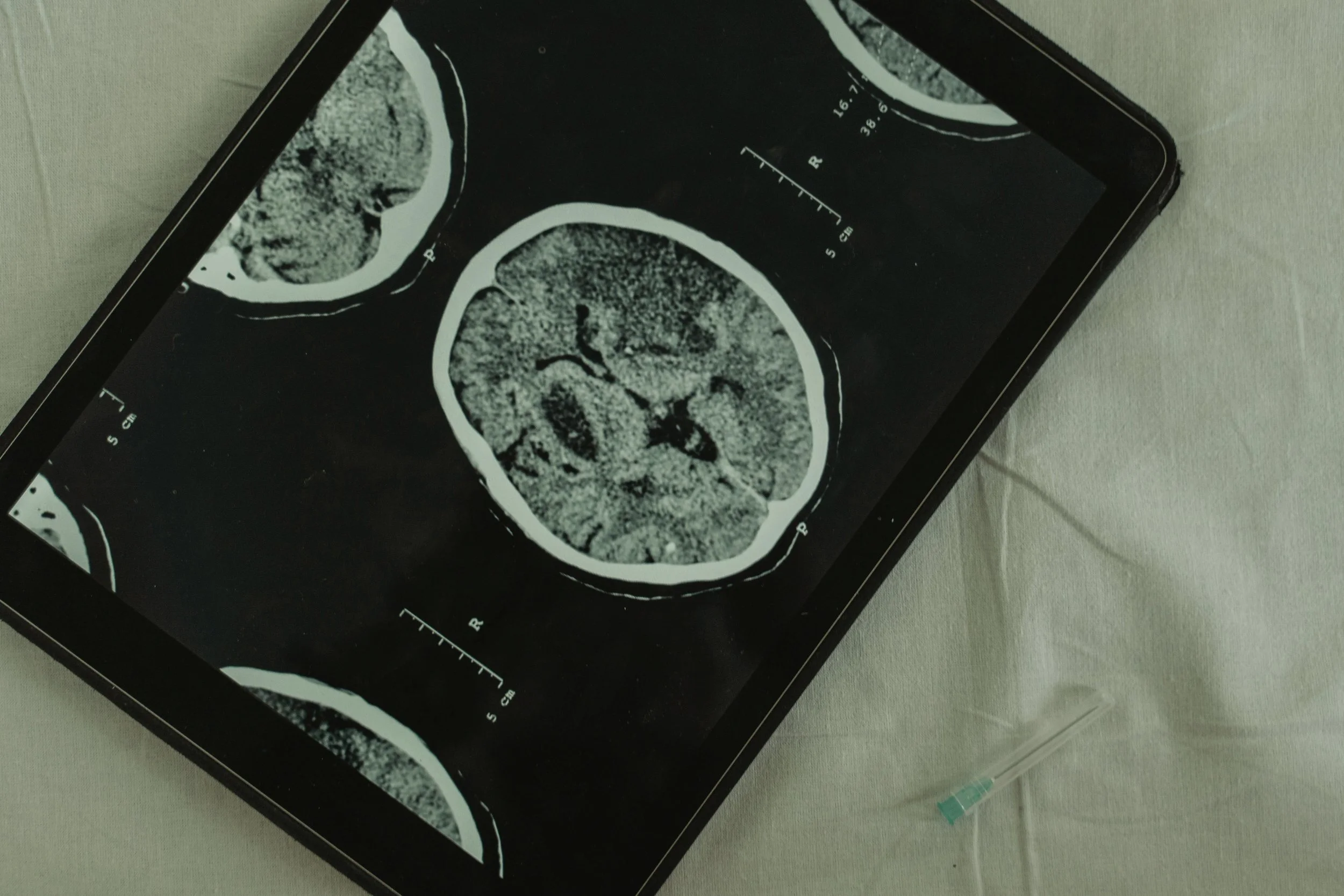 Brain Health & Advanced Therapies
