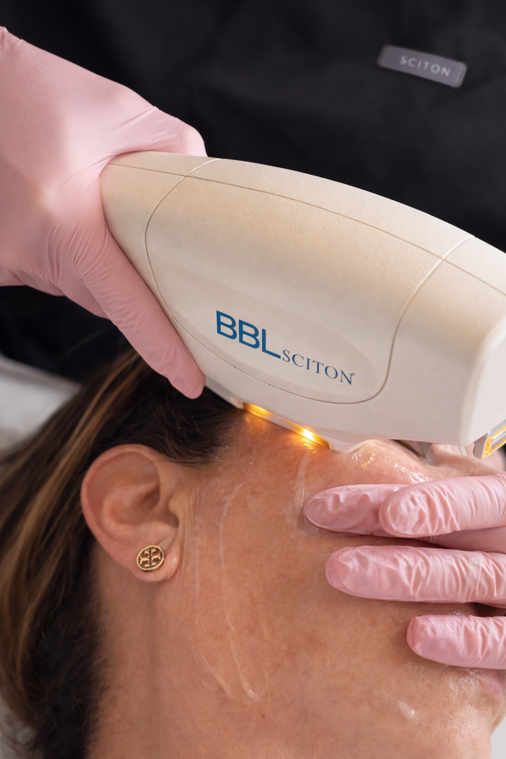Laser Treatments