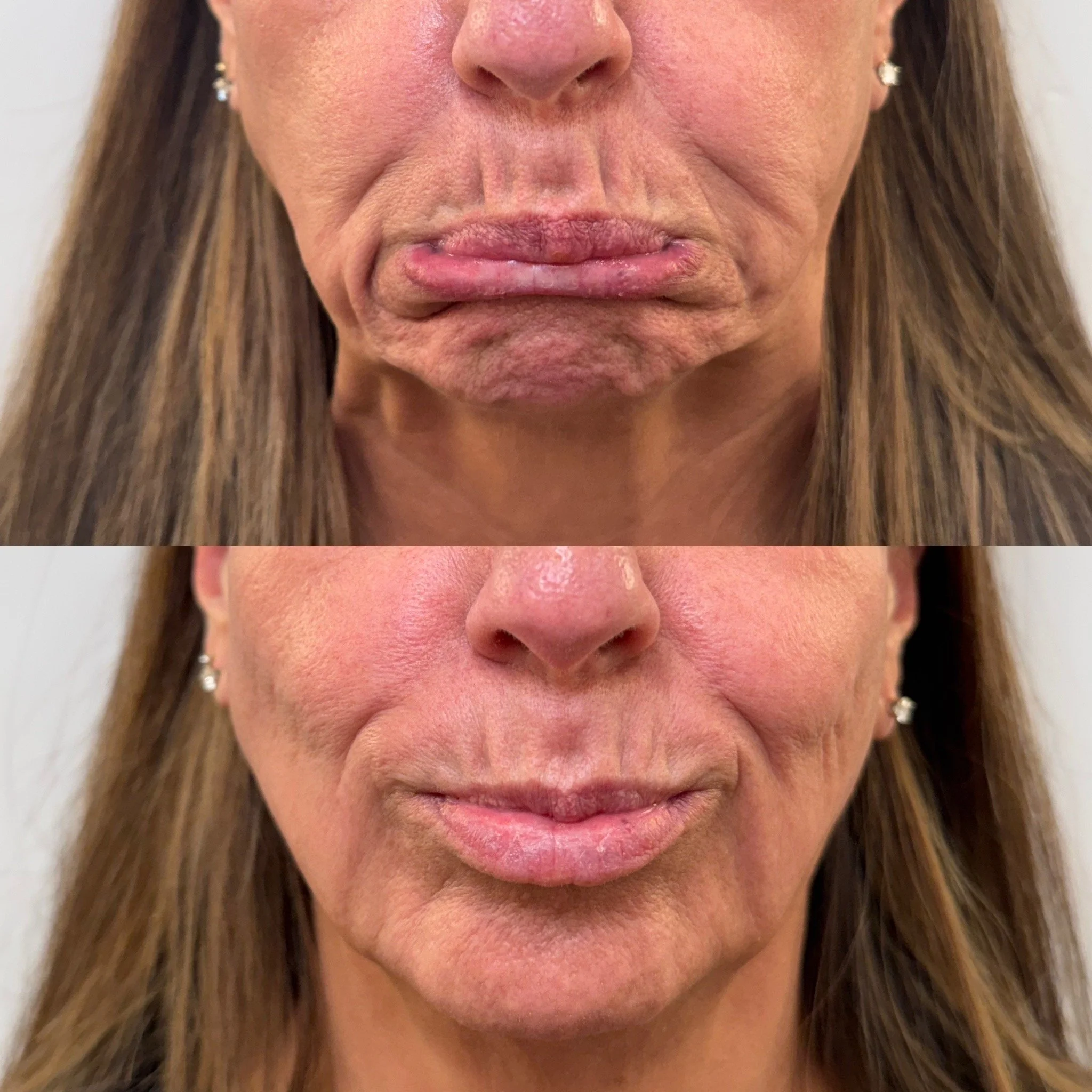 Before and after treatment results