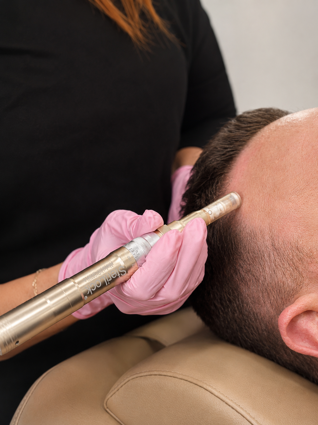 Hair restoration treatment being performed at Hidden Springs Med Spa in Boise, ID