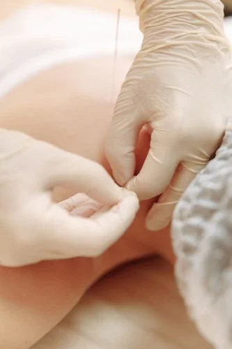 Clinic for Pain and Anxiety Beverly Hills — acupuncture near West LA