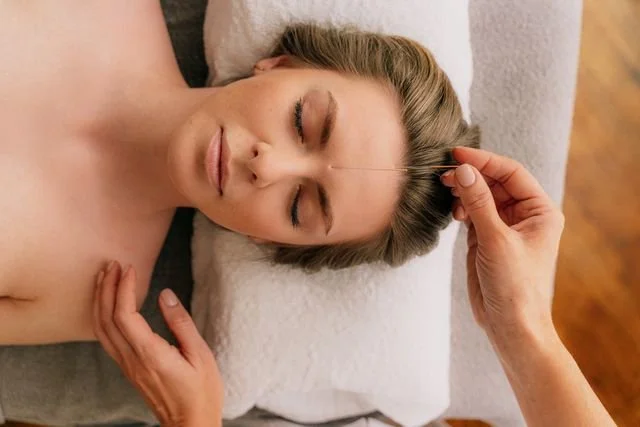 Cosmetic Acupuncture in Los Angeles