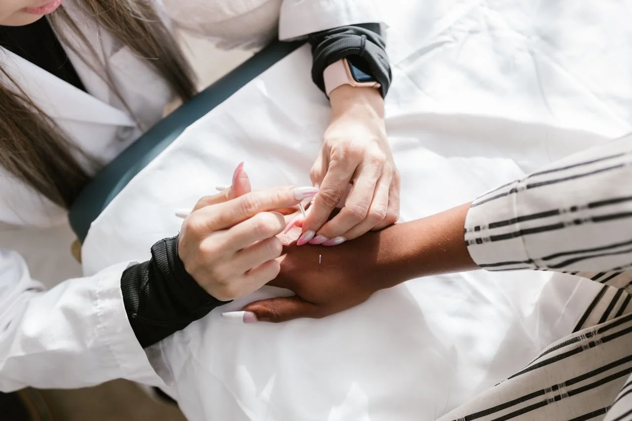Acupuncture near Westwood — Clinic for Pain and Anxiety Beverly Hills