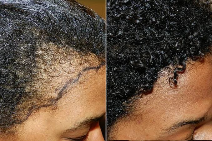 Illustrative hair and scalp concern