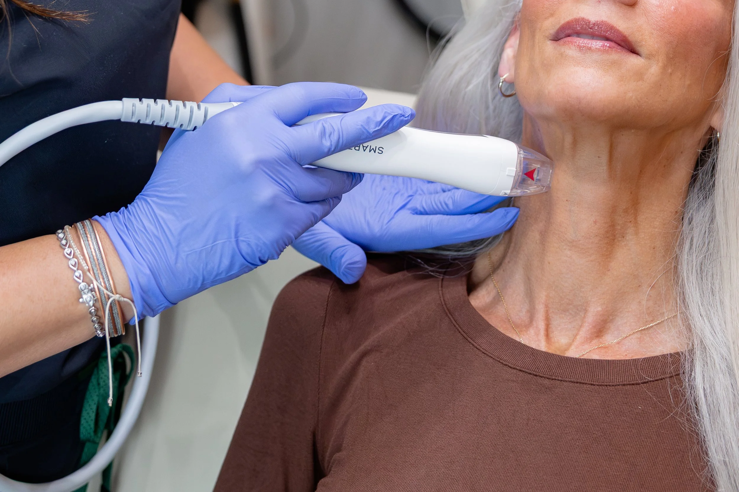 RF Microneedling VirtueRF Waynesville NC Well Aesthetics