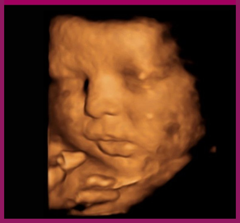 4D Baby Scan Cardiff