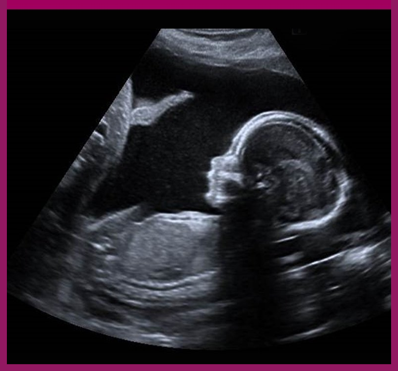 Growth Baby Scan Cardiff
