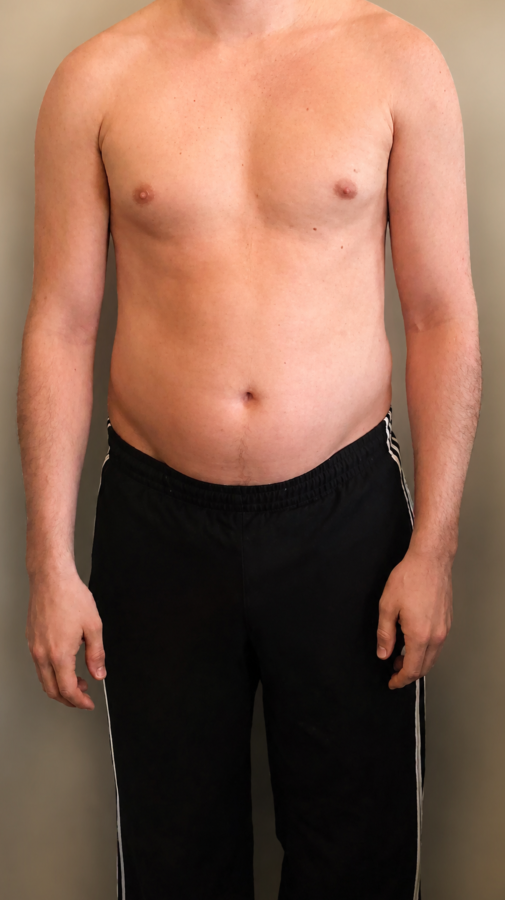Client 1 before personalized training and macro coaching