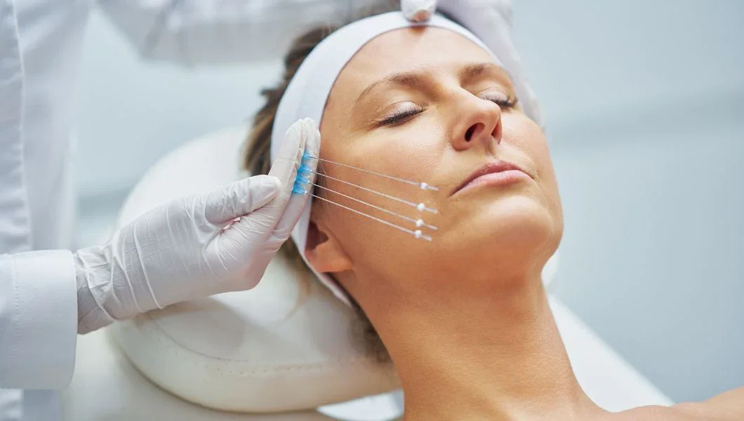 PDO thread lift and skin tightening treatment at Dr. B MedSpa in Bend, Oregon