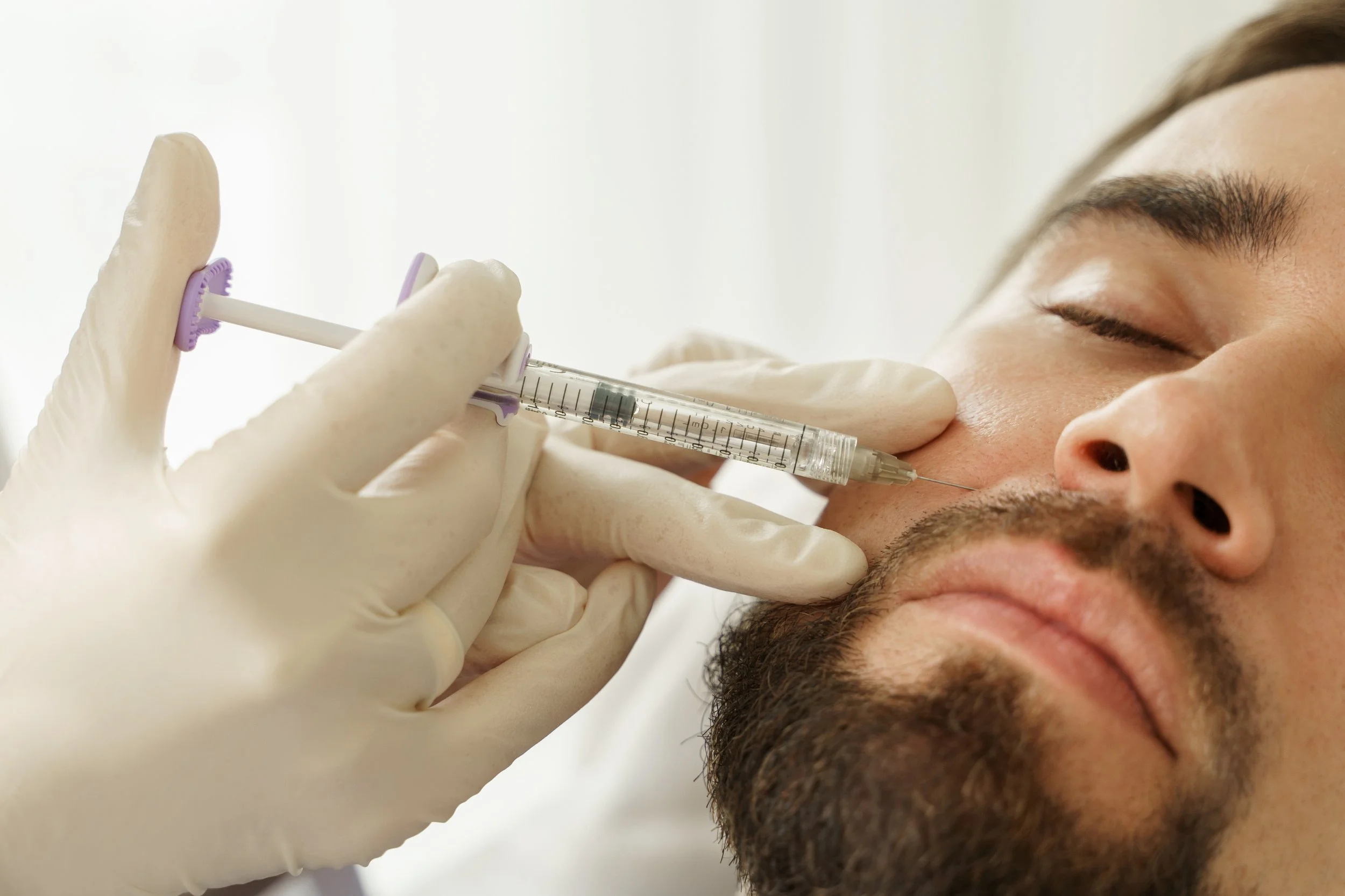 Dermal filler treatment at Dr. B MedSpa in Bend, Oregon
