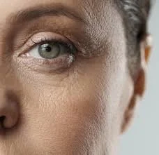 Laser skin rejuvenation treatment at Dr. B MedSpa in Bend, Oregon