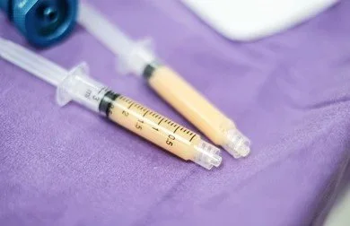 Nano fat and micro fat transfer procedure at Dr. B MedSpa in Bend, Oregon