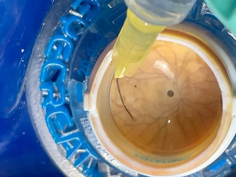 Eye 4 Vitrectomy during a vitrectomy exercise