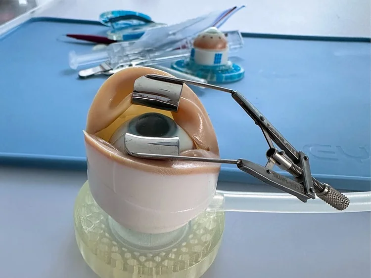 Porcine eye in the Vacuum Holder 4 Pigs with speculum