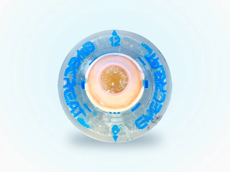 Eye 4 SchlemmSim Pro glaucoma training eye