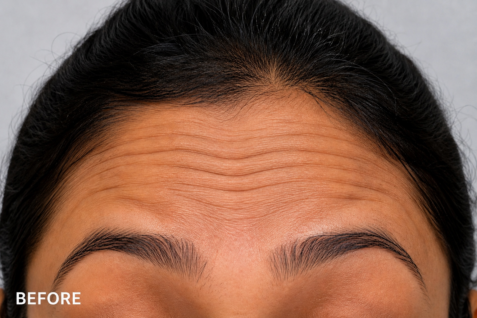 Before Treatment
