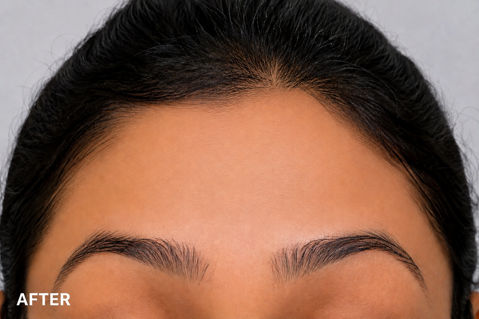 After Treatment