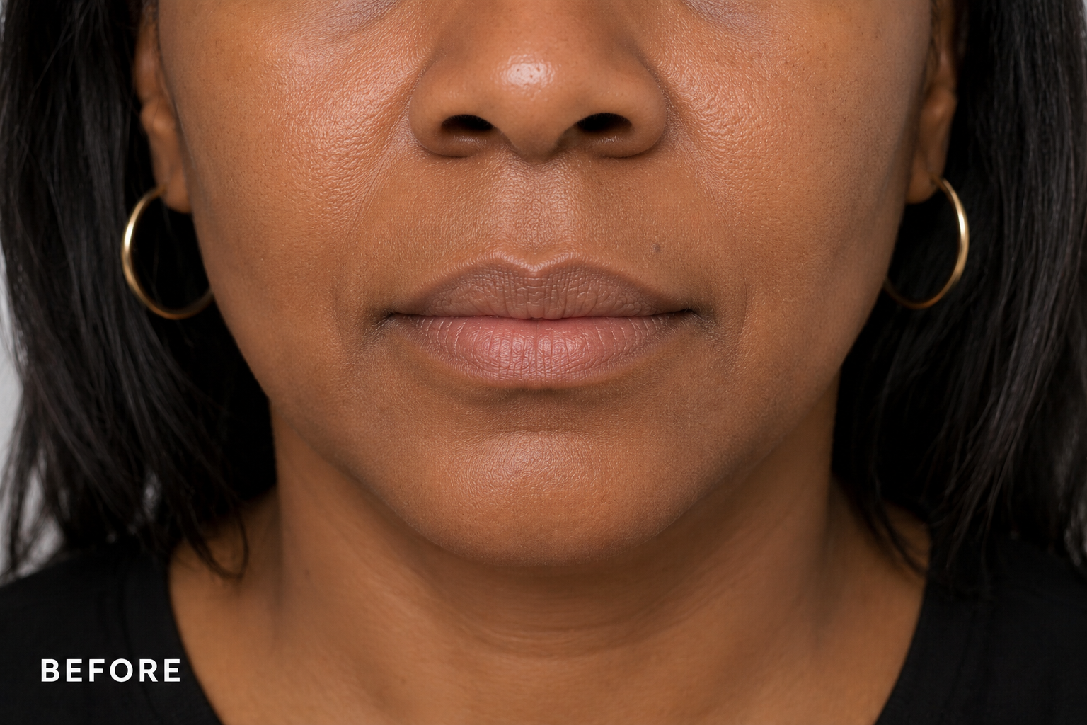 Before Treatment