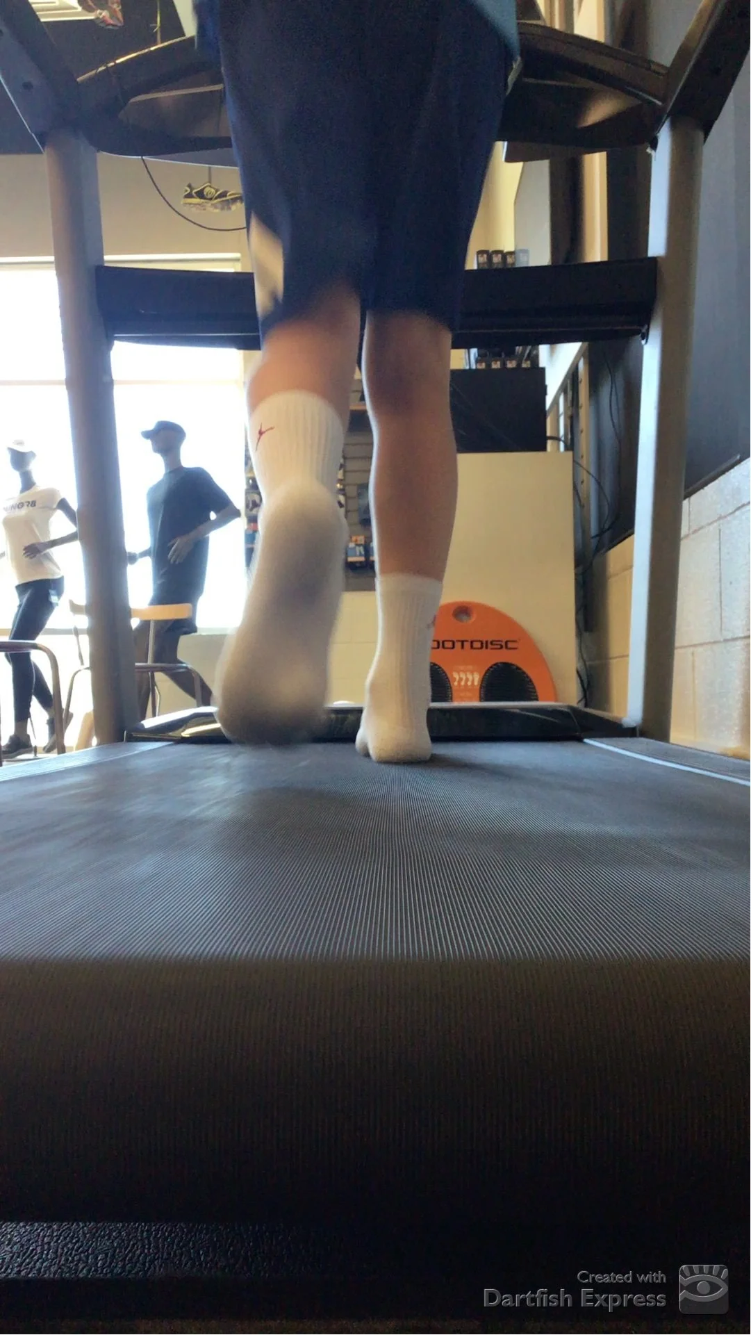 Gait Analysis on Treadmill