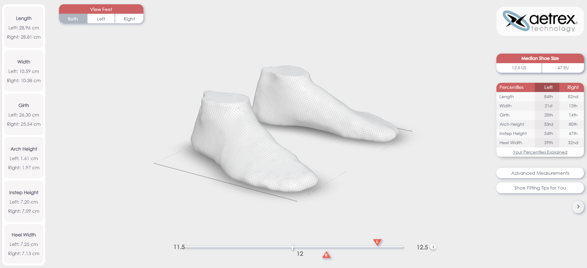 3D Foot Scan
