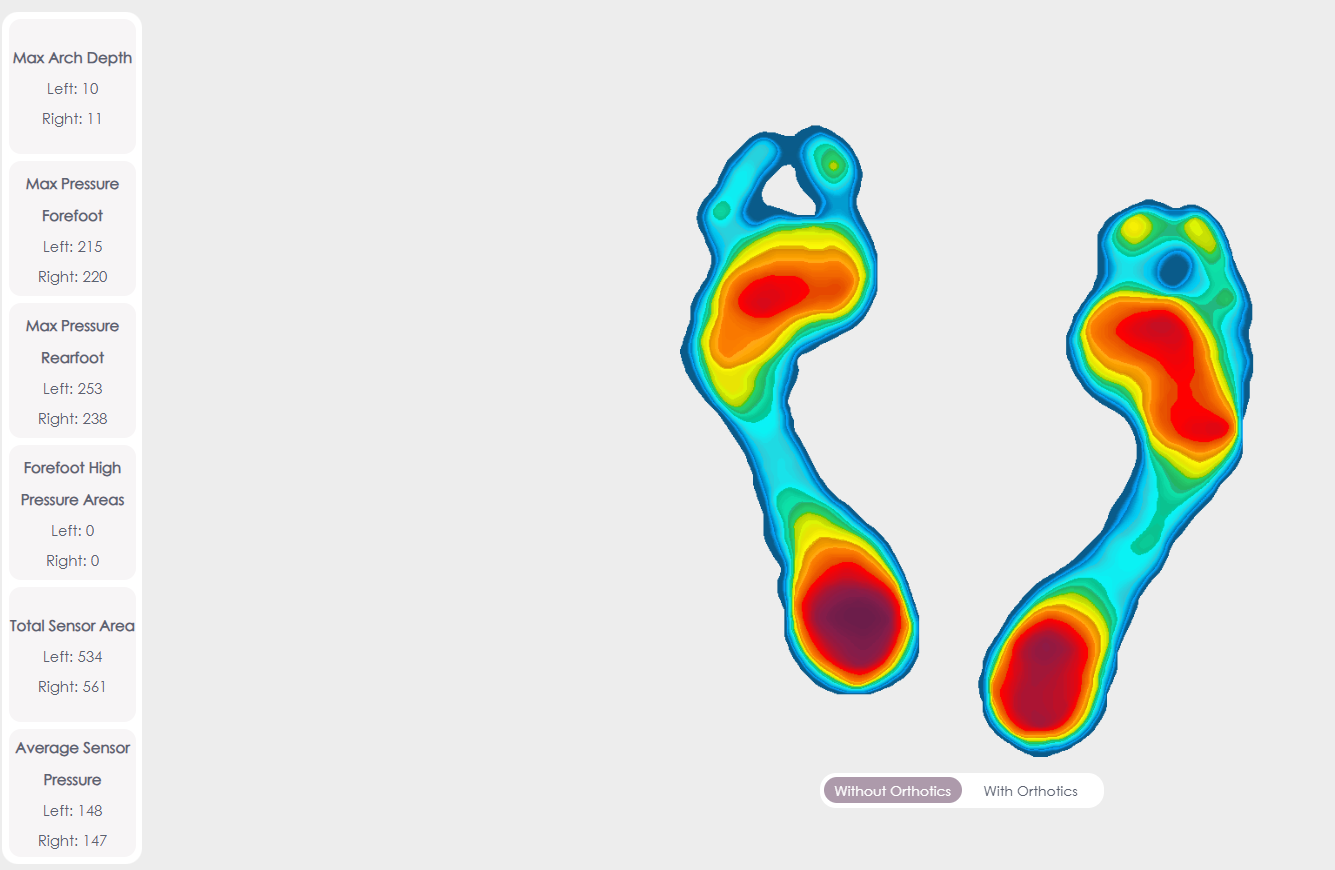 Foot Pressure Heat Map