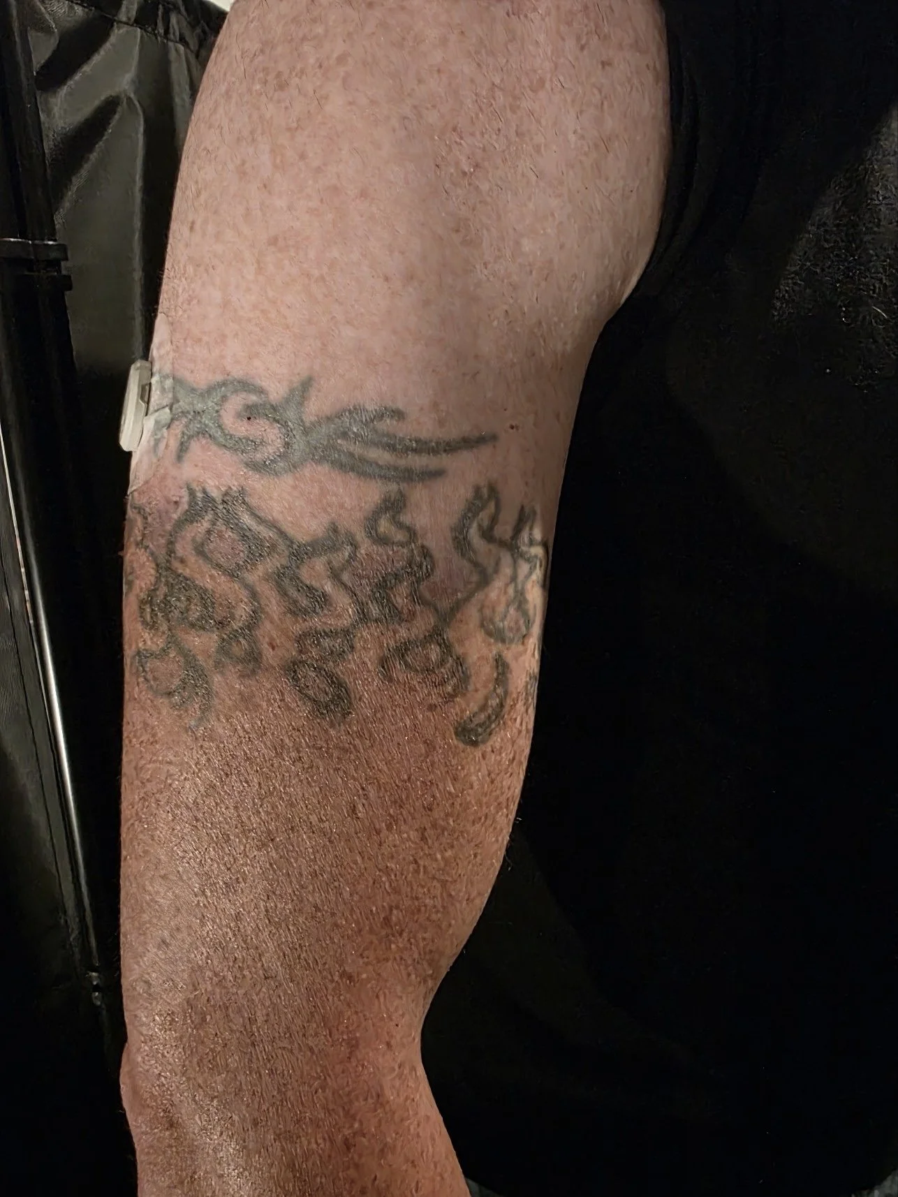 Armband tattoo before cover-up