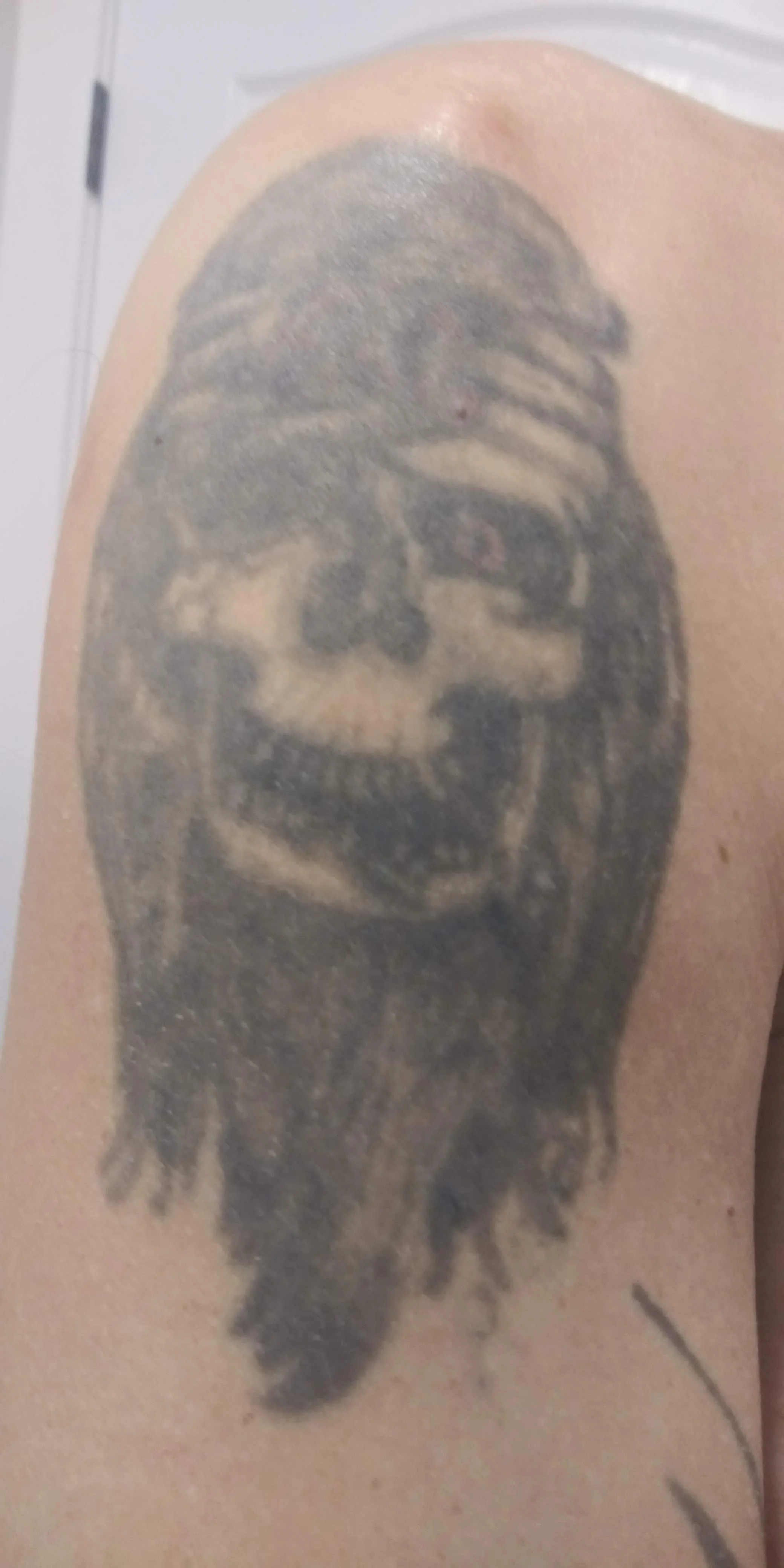 Skull tattoo before cover-up