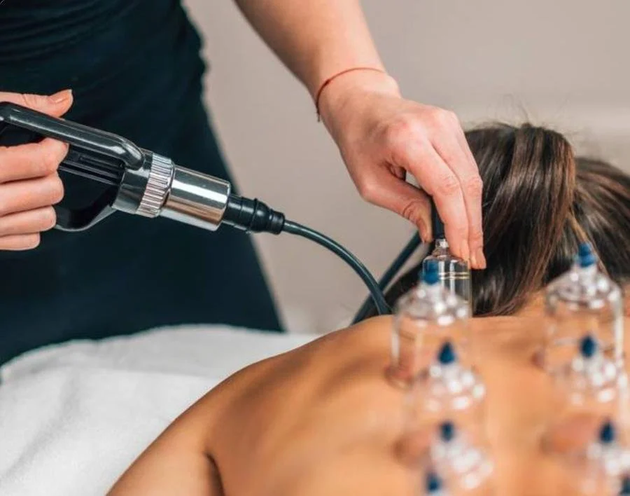 Cupping therapy on a client’s back