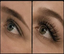 Lash Enhancement