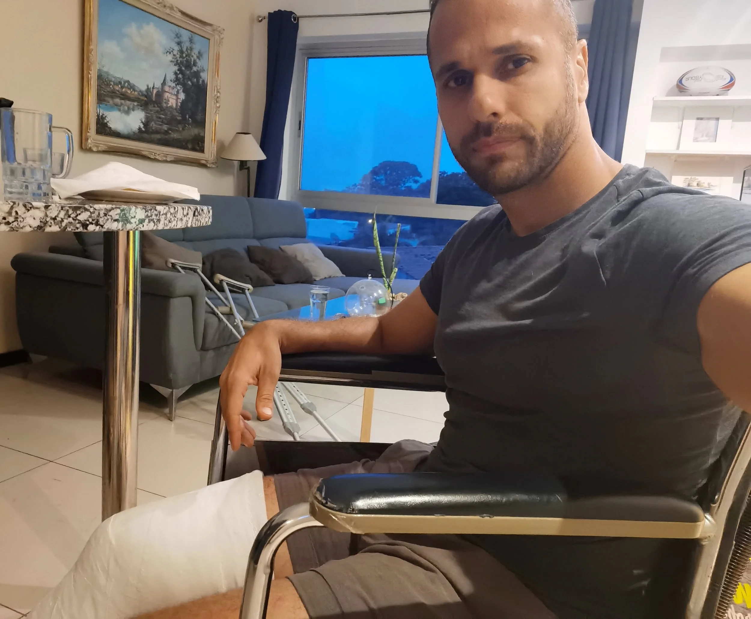Paul Rajput during his recovery from a double leg fracture, at home in Costa Rica