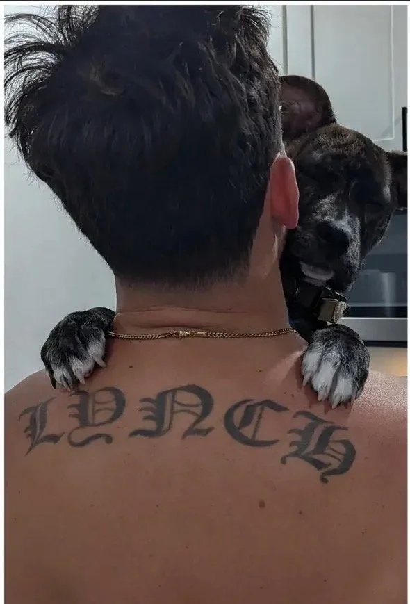 Before Tattoo Removal at EAE