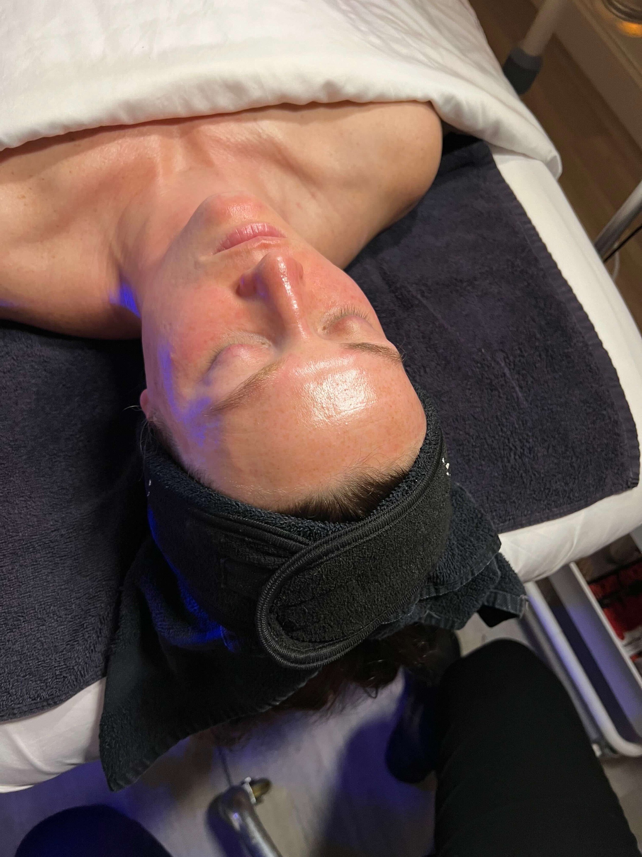 Before Hydrafacial at EAE