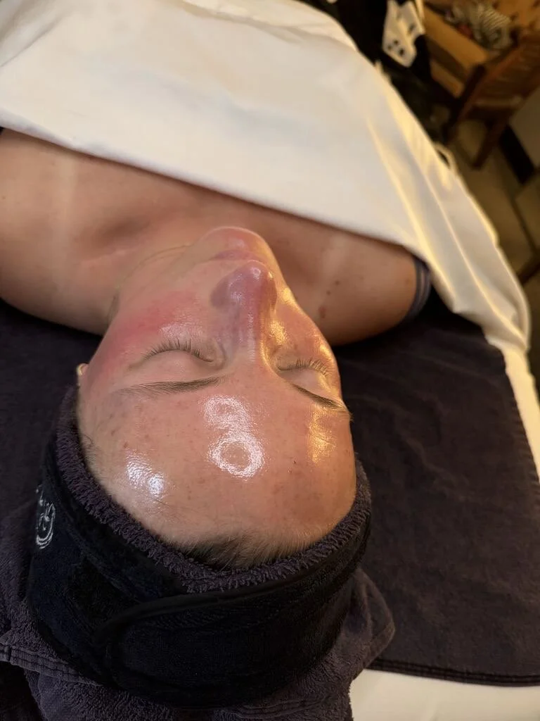 After Hydrafacial at EAE
