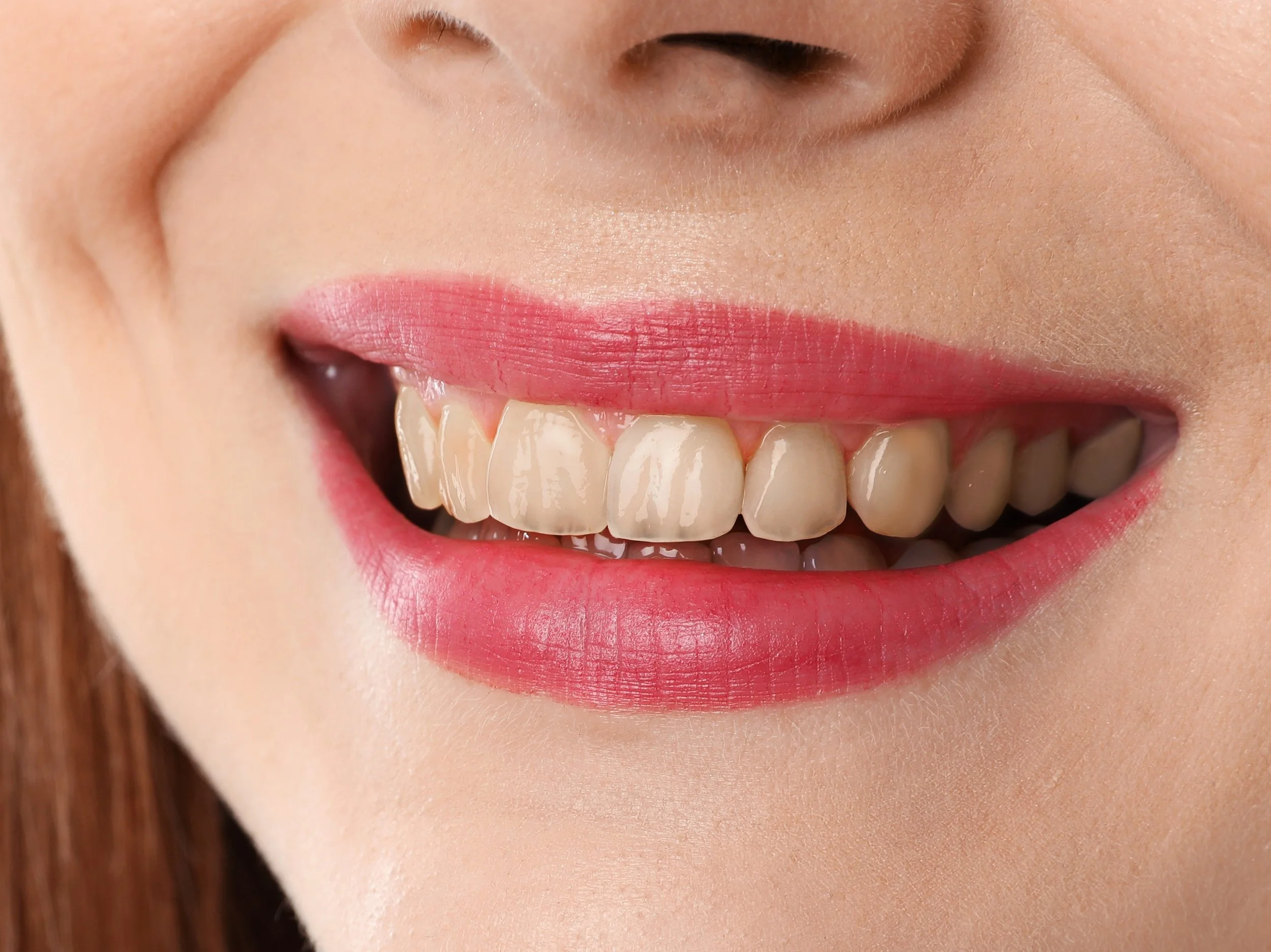 Smile after treatment