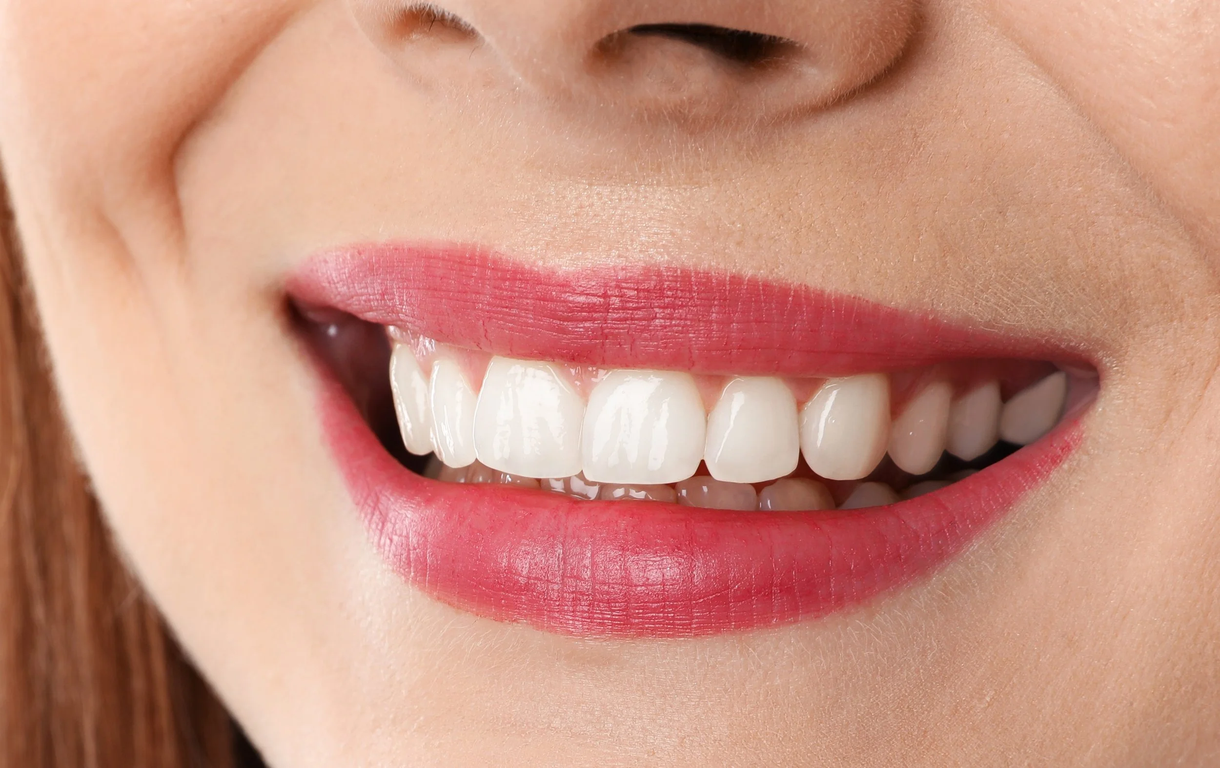 Smile before treatment
