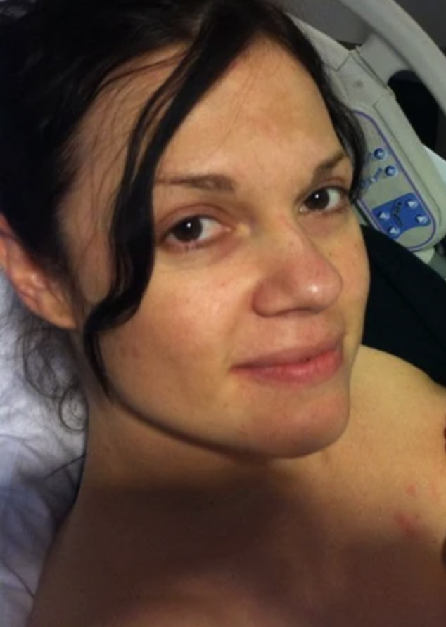 Before treating photodamaged skin