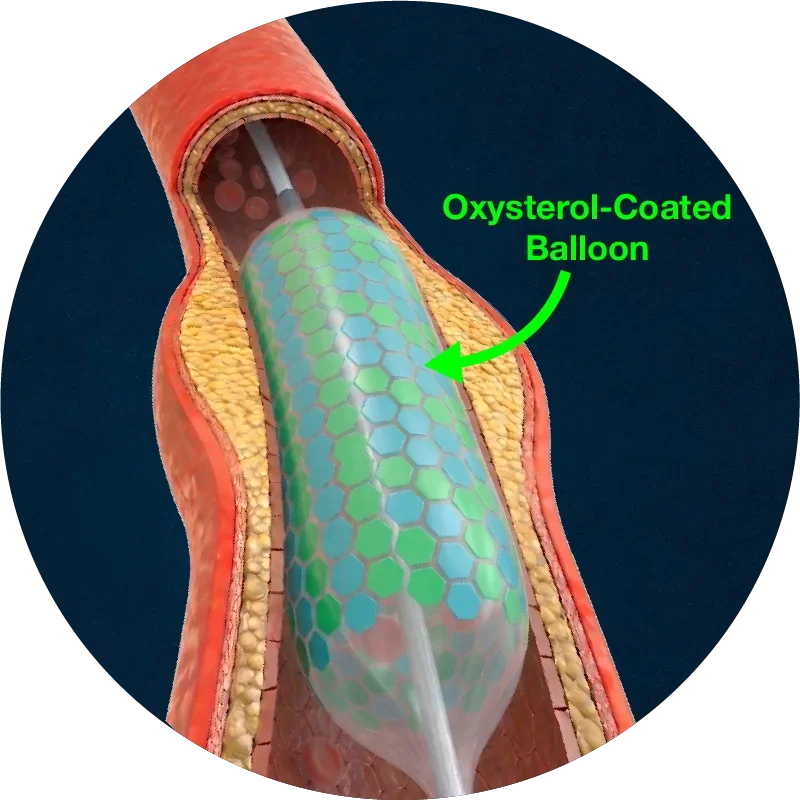 Localized oxysterol delivery to the vessel wall