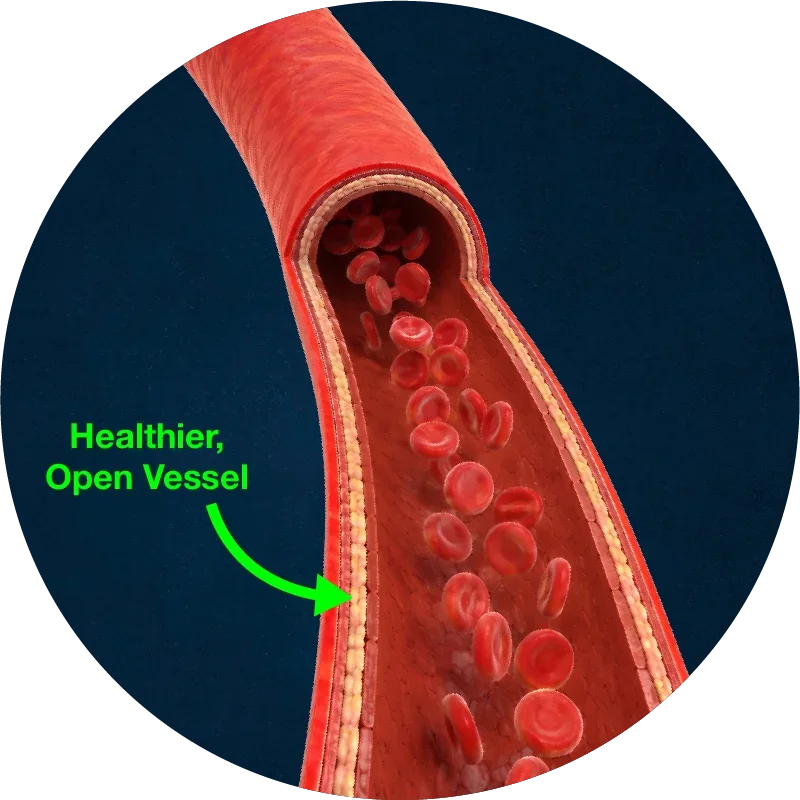 Healthier open vessel with restored blood flow